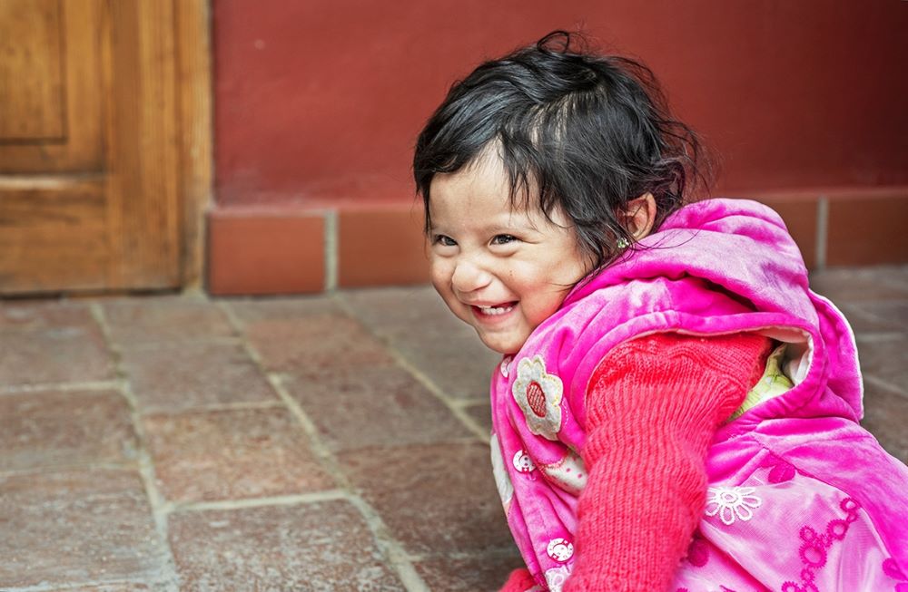 Eight-months-old Heydi after cleft lip surgery.Photo: Margherita Mirabella