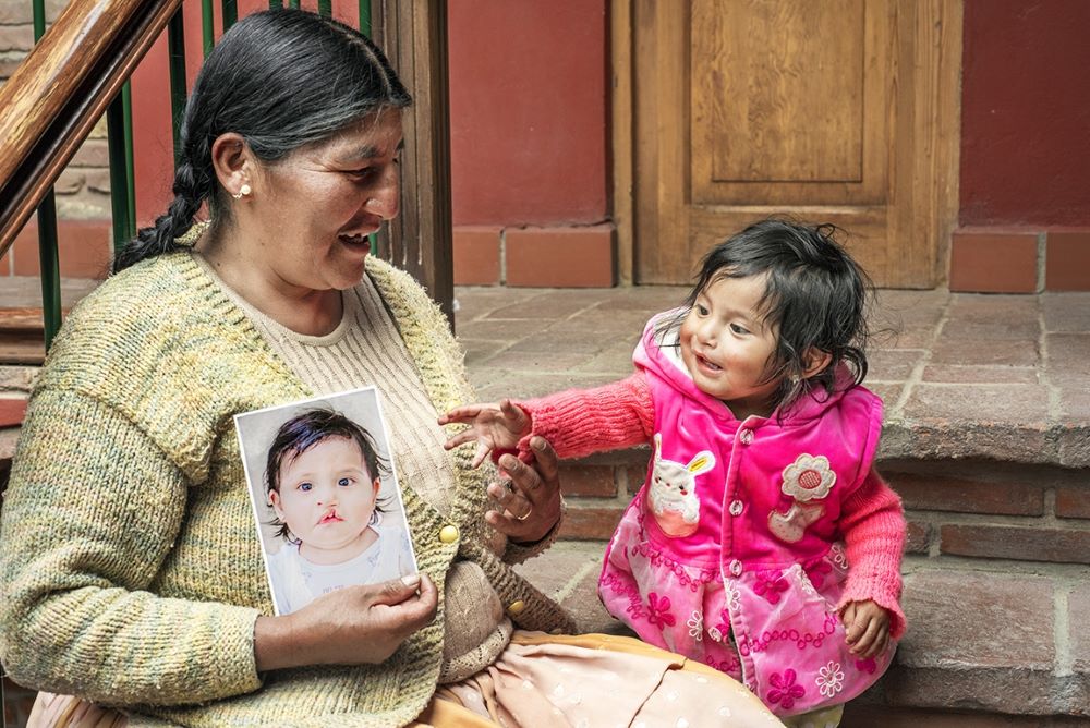 Heydi and Claudina, holding a photo of Heydi before cleft lip surgery