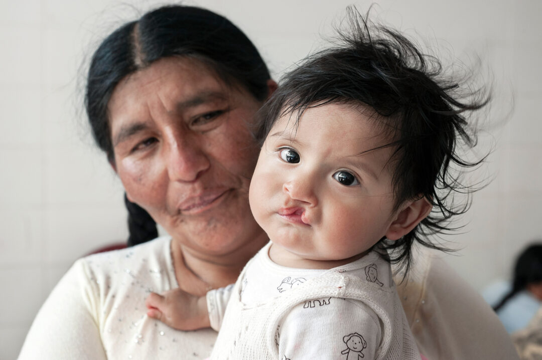 Baby girl with cleft being held by her grandmother
