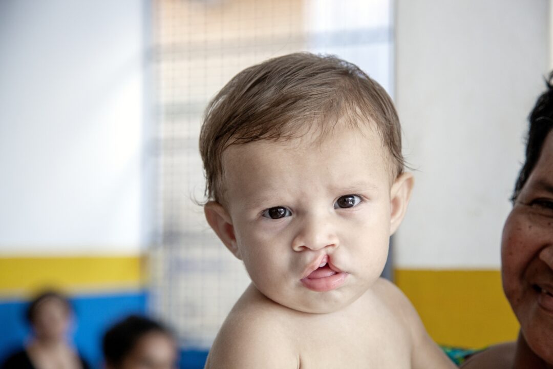 Meet 8-month-old Fredy. Photo: Paulo Fabre.